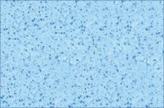 King Pools & Spas - Plaster